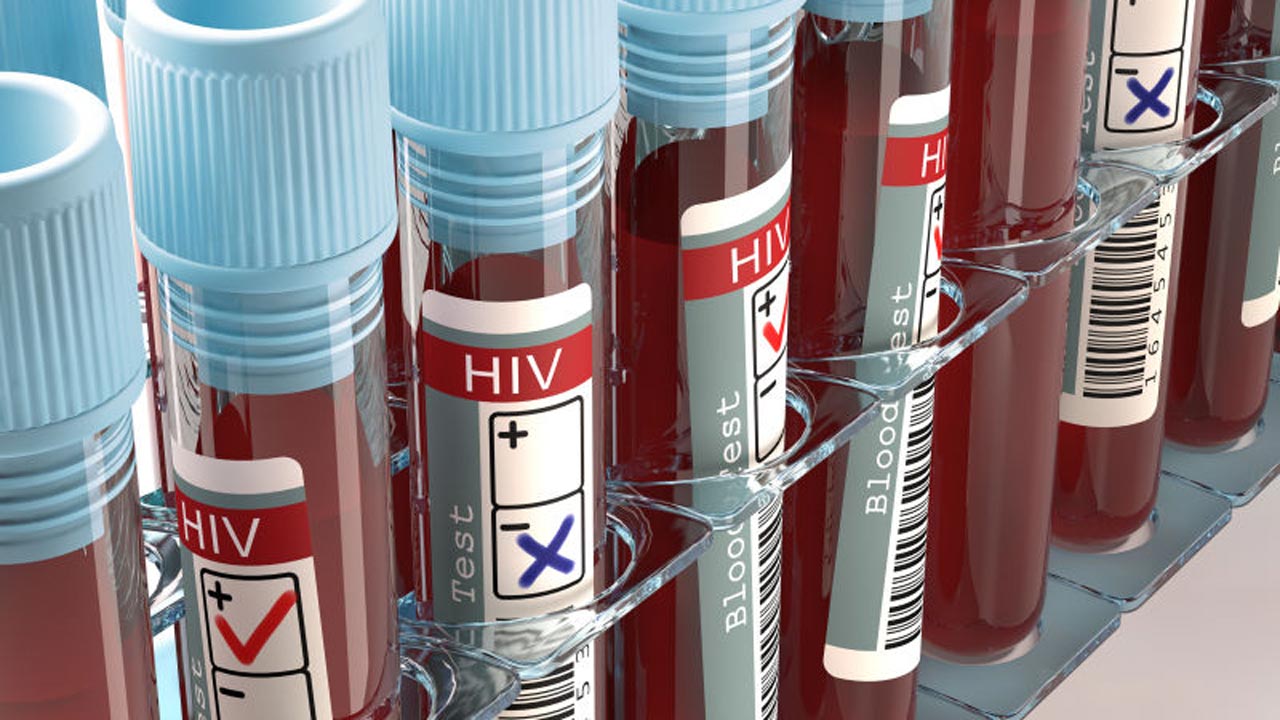 HIV Cure- Is the World Heading Towards being HIV Free?