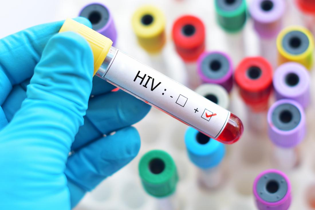 Is HIV curable now?