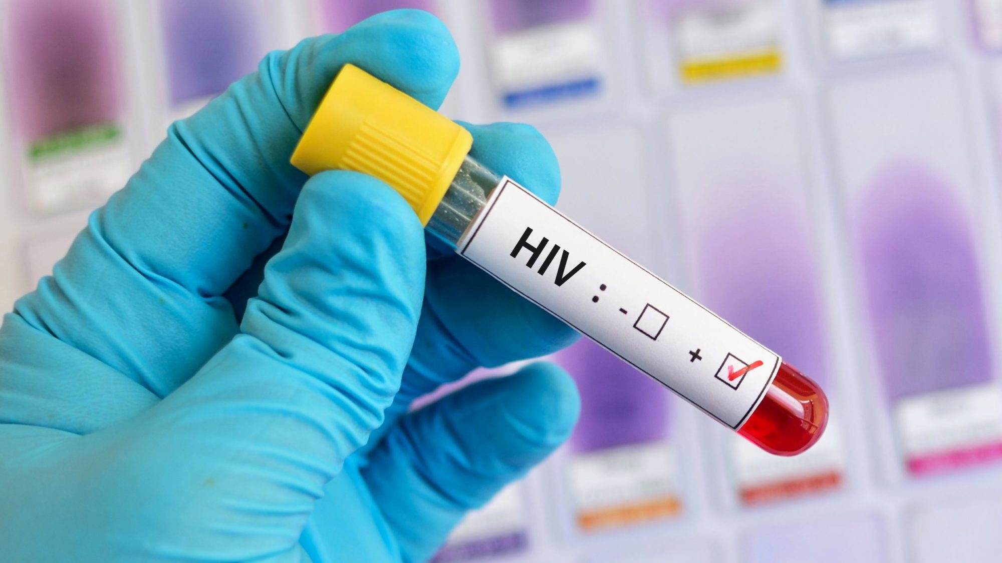 Cure for HIV/AIDS 2019: Groundbreaking Vaccine Successfully Clears ...