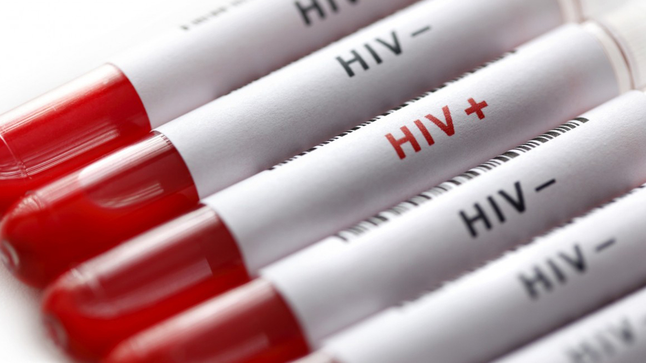 new research hiv cure