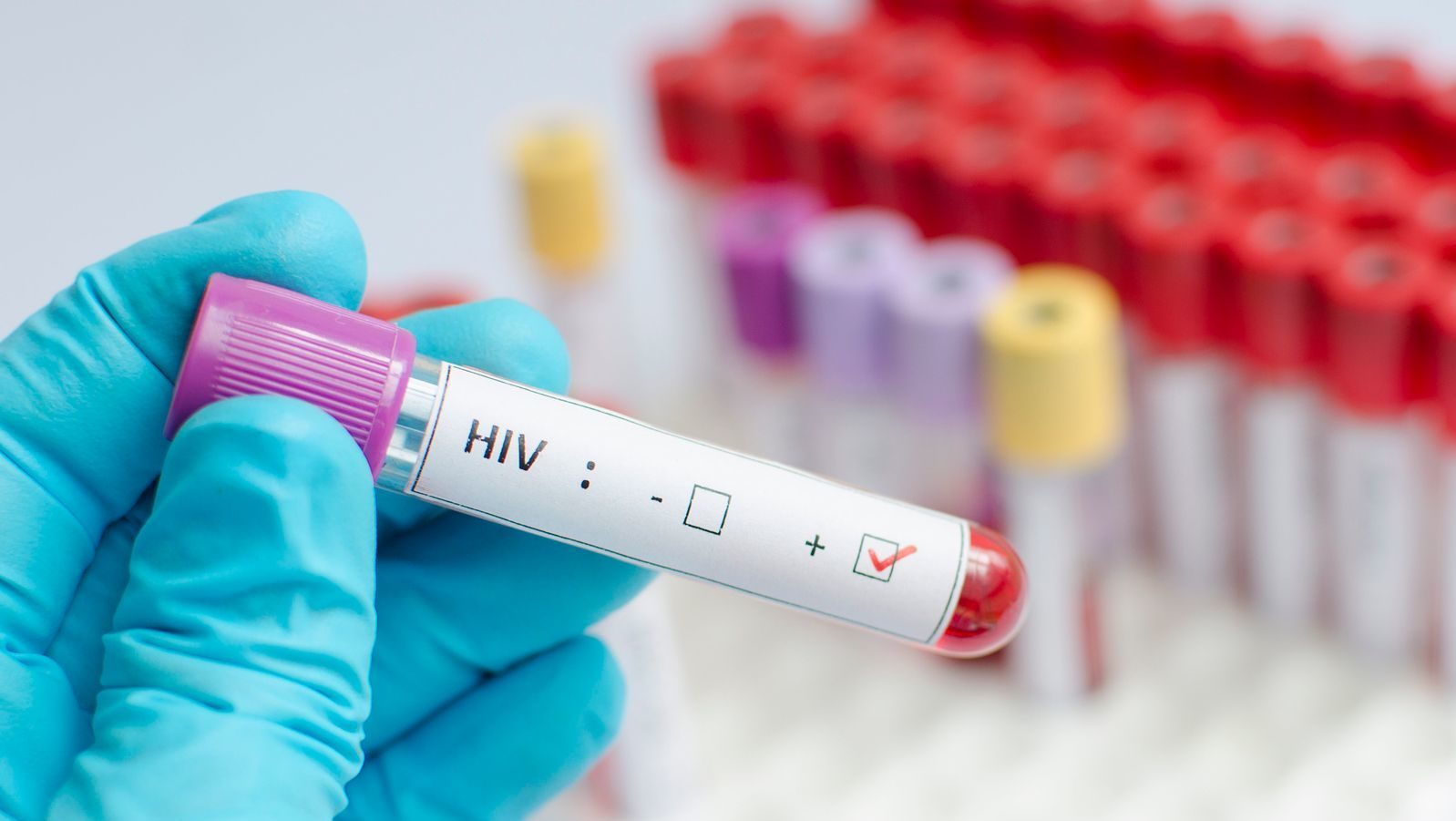 Cure for HIV AIDS Scientists Discovers Genes to End HIV Infection from Source