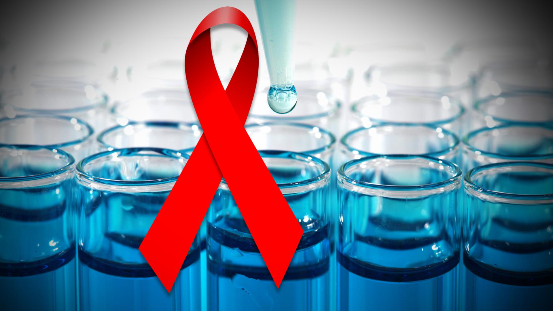 Cure for HIV AIDS Early Diagnosis can Prevent Late Stage HIV and AIDS