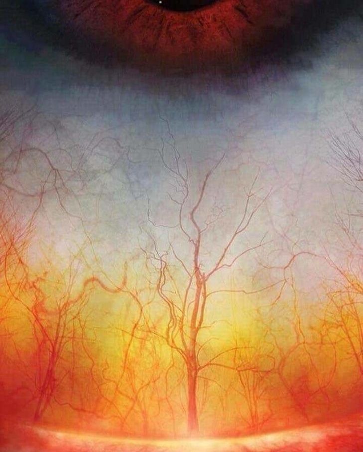 A high-definition photograph of blood vessels in a human eye looks like a creepy forest