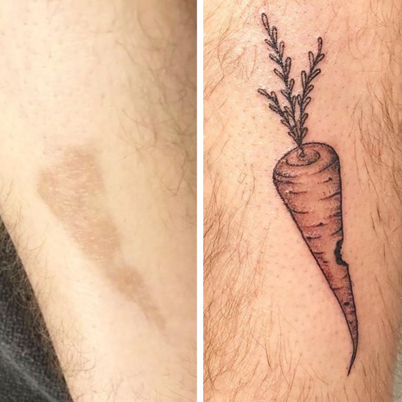 20+ People Who Brilliantly Covered Up Their Birthmarks And Scars With Tattoos