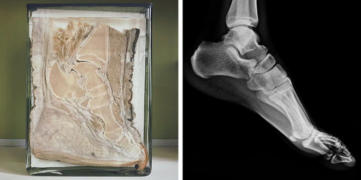 There's almost no difference between an animal foot and human foot