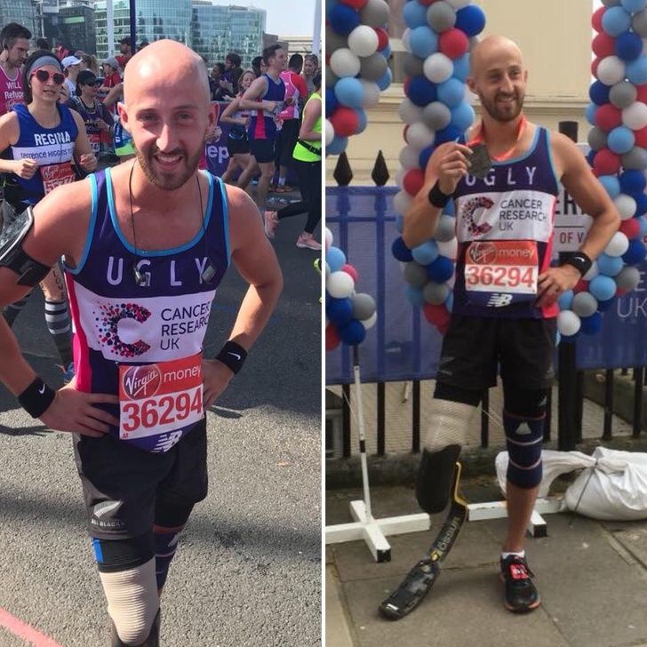 Never leave hope: He lost his leg due to cancer. But hope is the most powerful weapon. And he has completed the London Marathon!