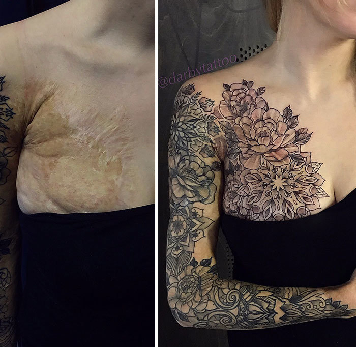 20+ People Who Brilliantly Covered Up Their Birthmarks And Scars With Tattoos
