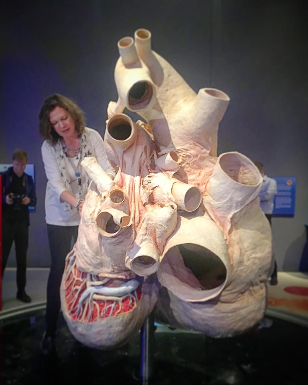 Different Size: This is a blue whale heart! It weighs around 400 lb and can be up to 5 feet long in size. 
