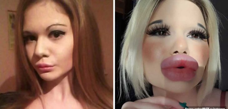 post talking a girl spending money on lip fillers to hold a world record