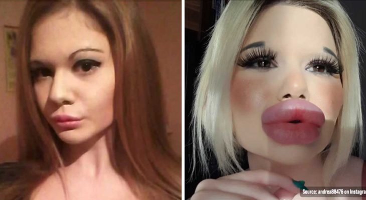 post talking a girl spending money on lip fillers to hold a world record