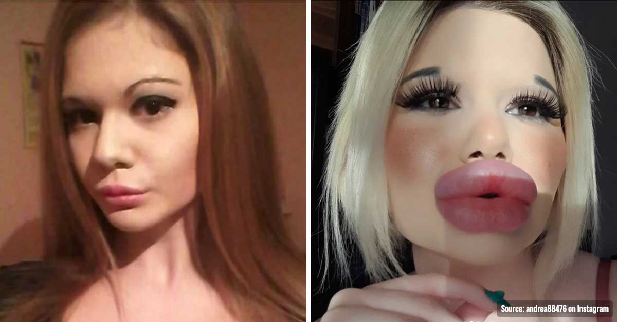 post talking a girl spending money on lip fillers to hold a world record