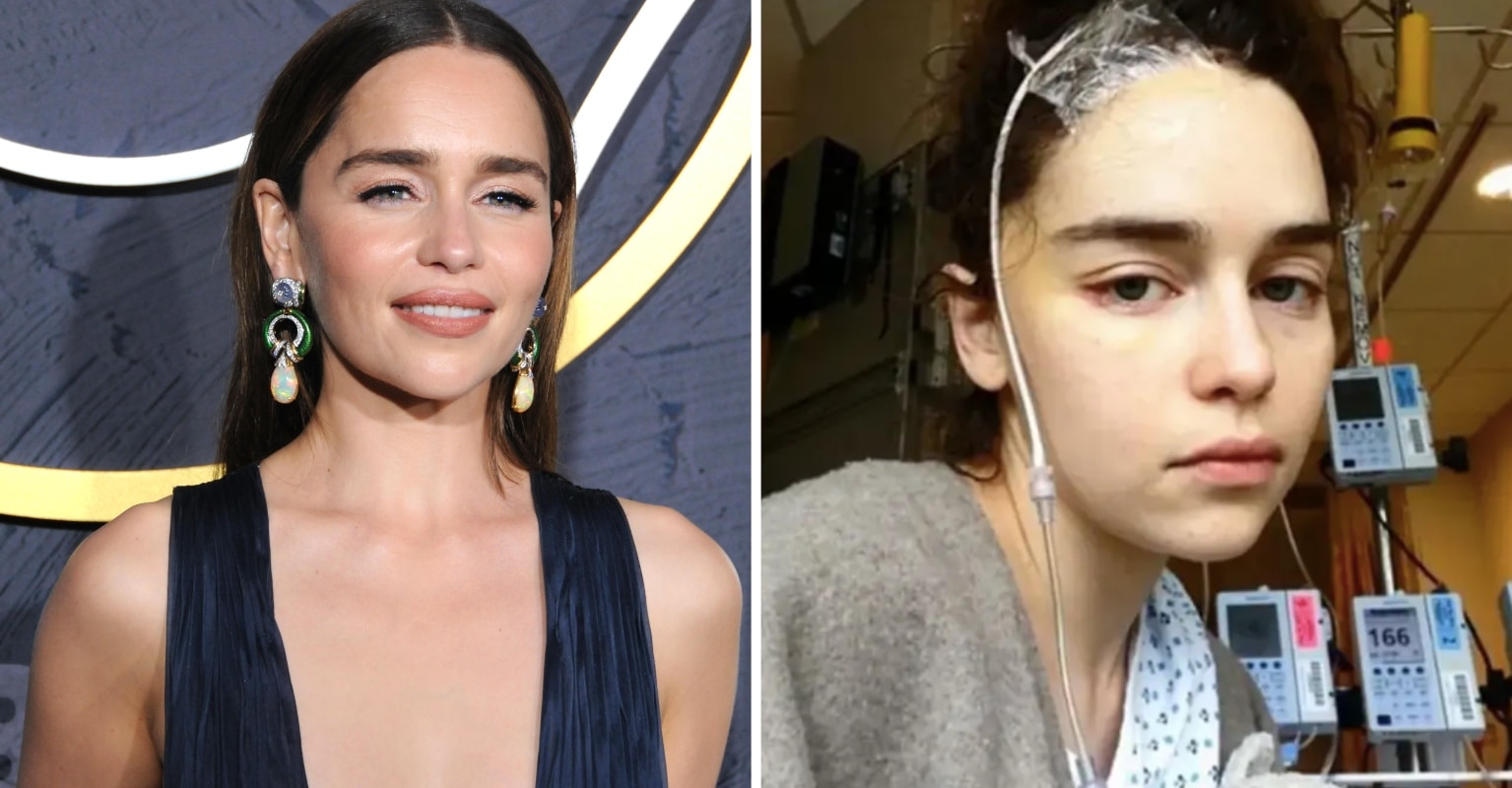 Emilia Clarke Reveals She's Missing 'Quite a Bit' of Her Brain Following Two Aneurysms