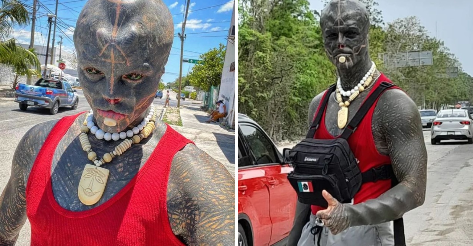 ‘Black Alien’ Is Considering Leg Amputation After Having Ears, Lips and Fingers Sliced Off