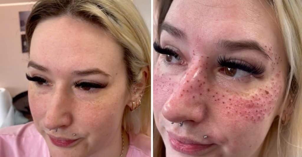 Woman Divides After Traveling 700 Miles to Get Freckles(01)
