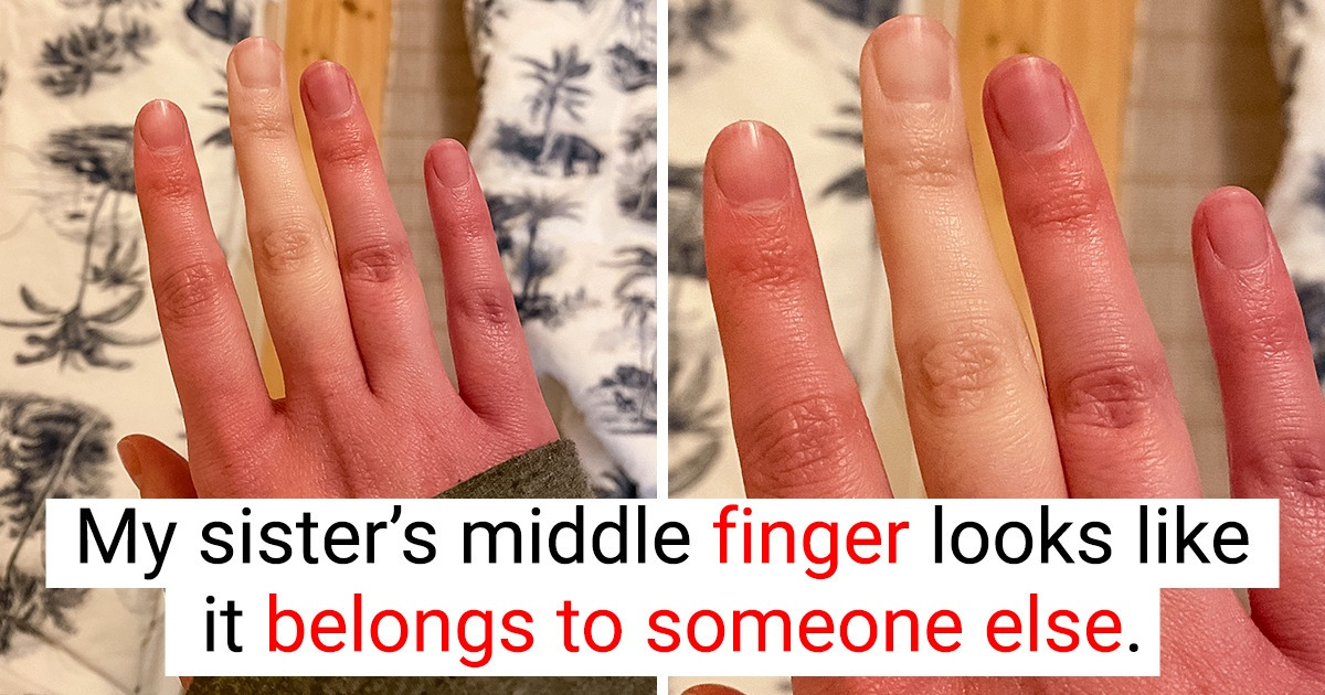 Times When Nature Prepared Surprises That Made Us Curious (10+ Pics)