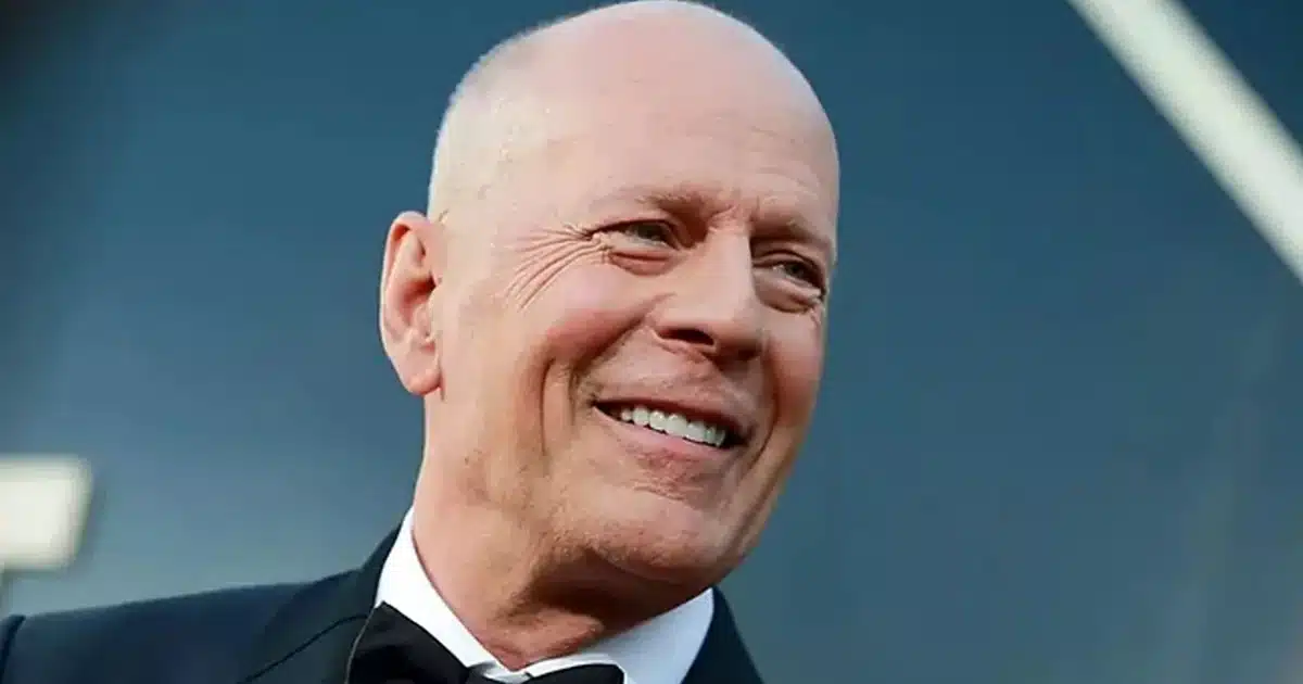 Bruce Willis, 67, Living With Dementia