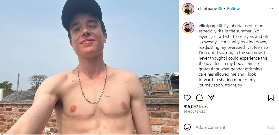 Elliot Page, "Umbrella Academy" Star, Posts Shirtless Pic Following Transition Surgery
