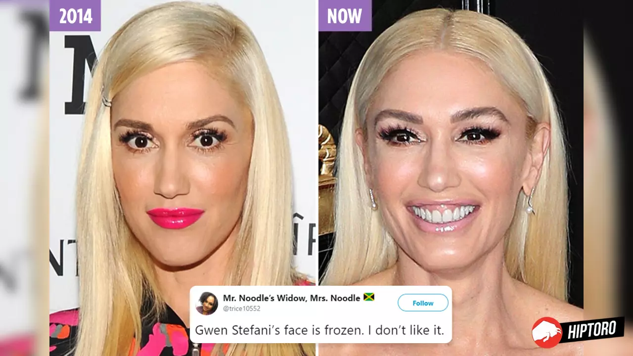 Did Gwen Stefani Really Spend $100K On Facial Treatments To Avoid Aging?