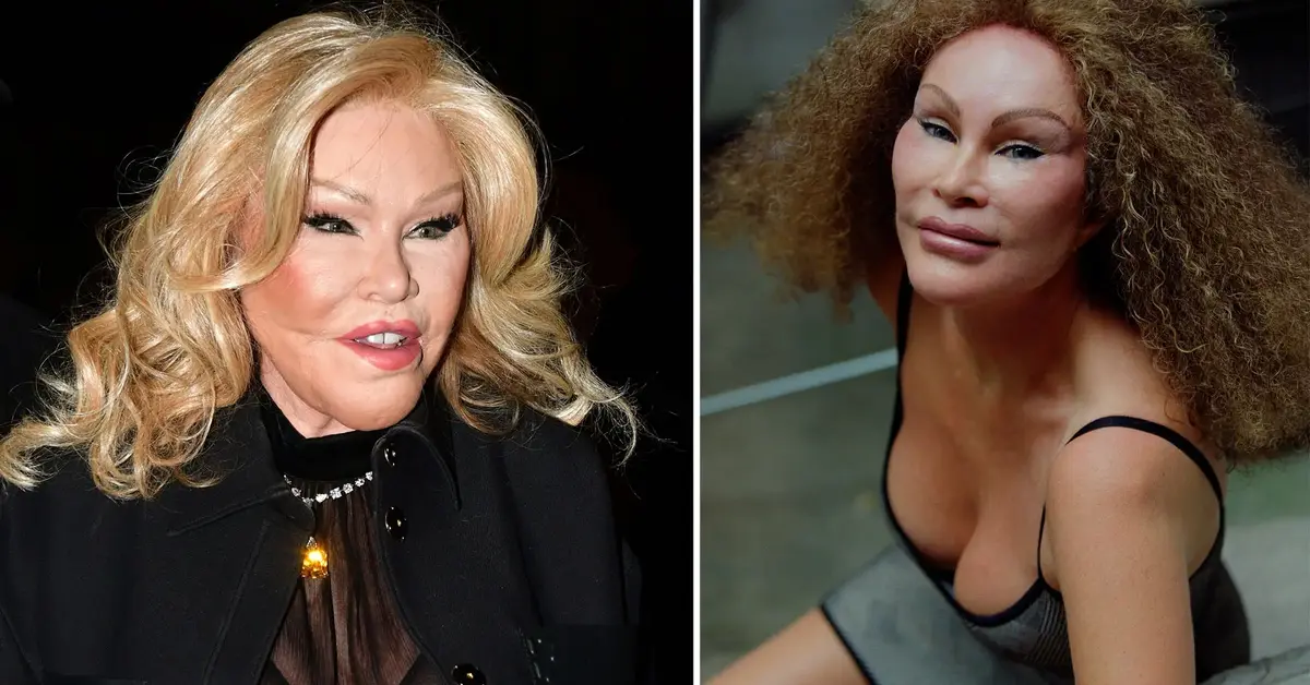 Jocelyn Wildenstein