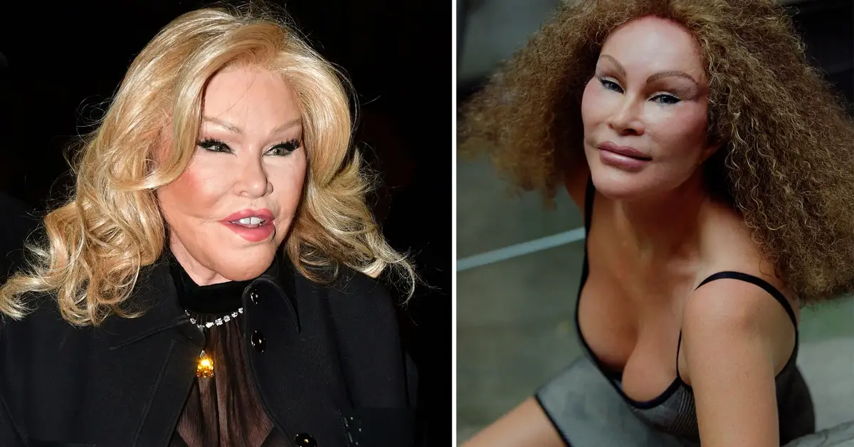 Despite Receiving $2.5 Billion in Divorce Money from Her Ex-husband and $100 Million Annually for 13 Years, Bankrupt Jocelyn Wildenstein Now Relies on 'Government Grant'