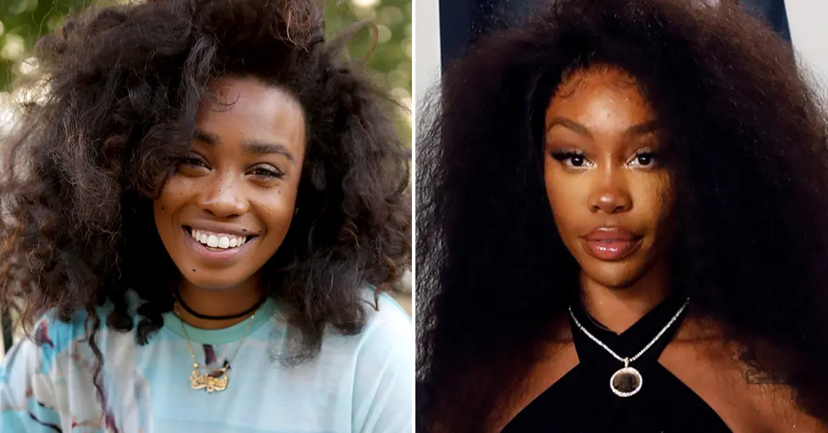 SZA's before and after