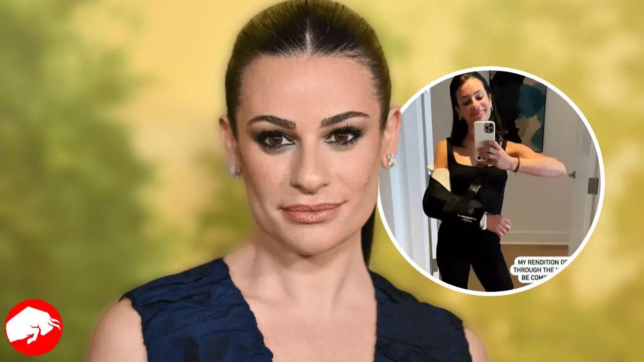‘Glee’ Star Lea Michele Shares Picture of Broken Arm After Suffering Injury