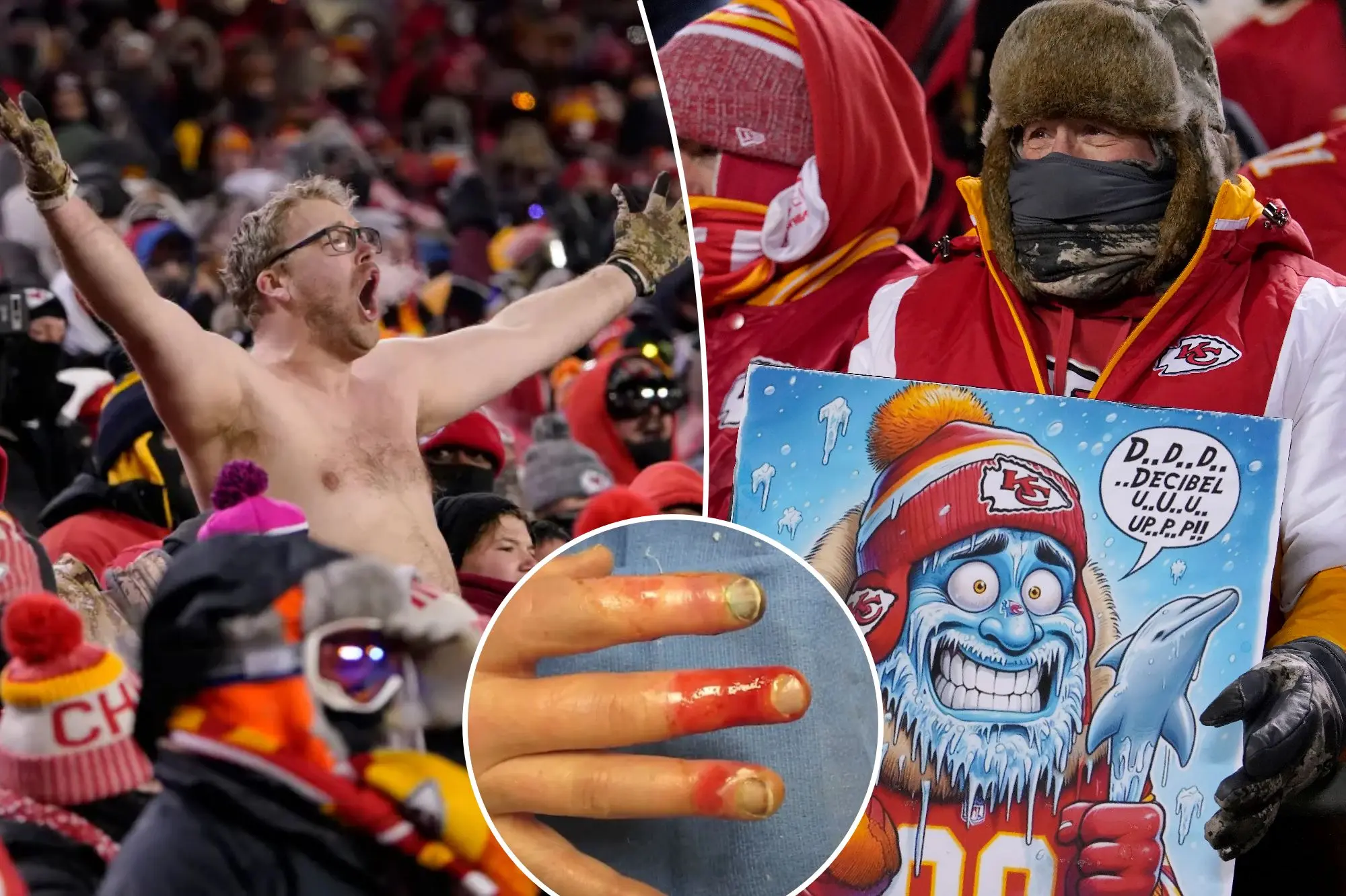 NFL News: Kansas City Chiefs Fans' Nightmare- Frostbite and Frenzy in Frozen Arrowhead Hellscape